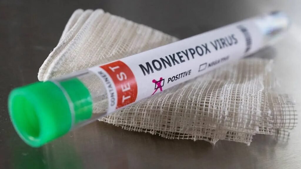 monkeypox virus